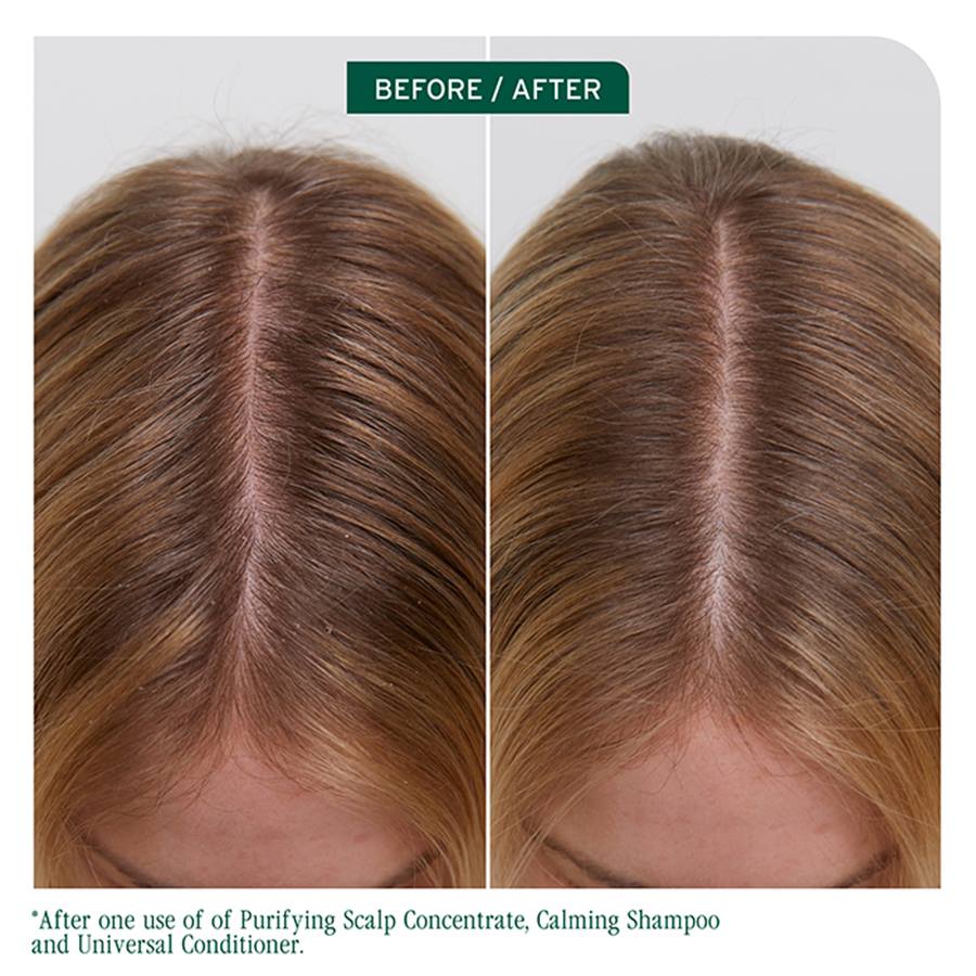 Scalp Sync Purifying Scalp Concentrate